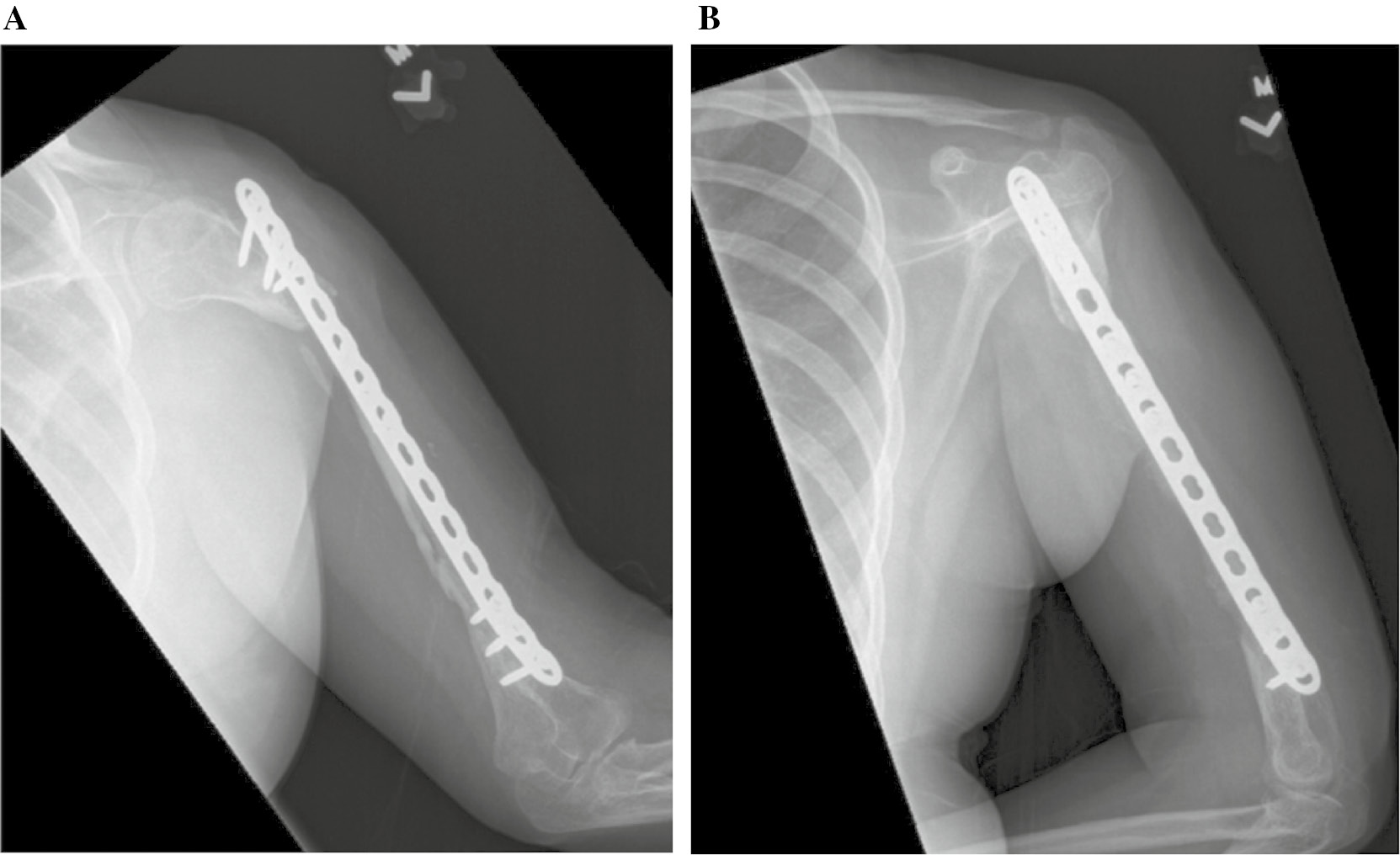 jposna20220026_fig4.jpg