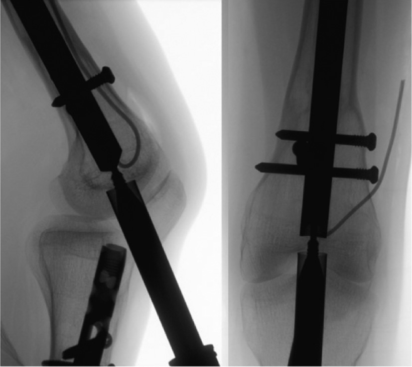 jposna20220031_fig33.jpg