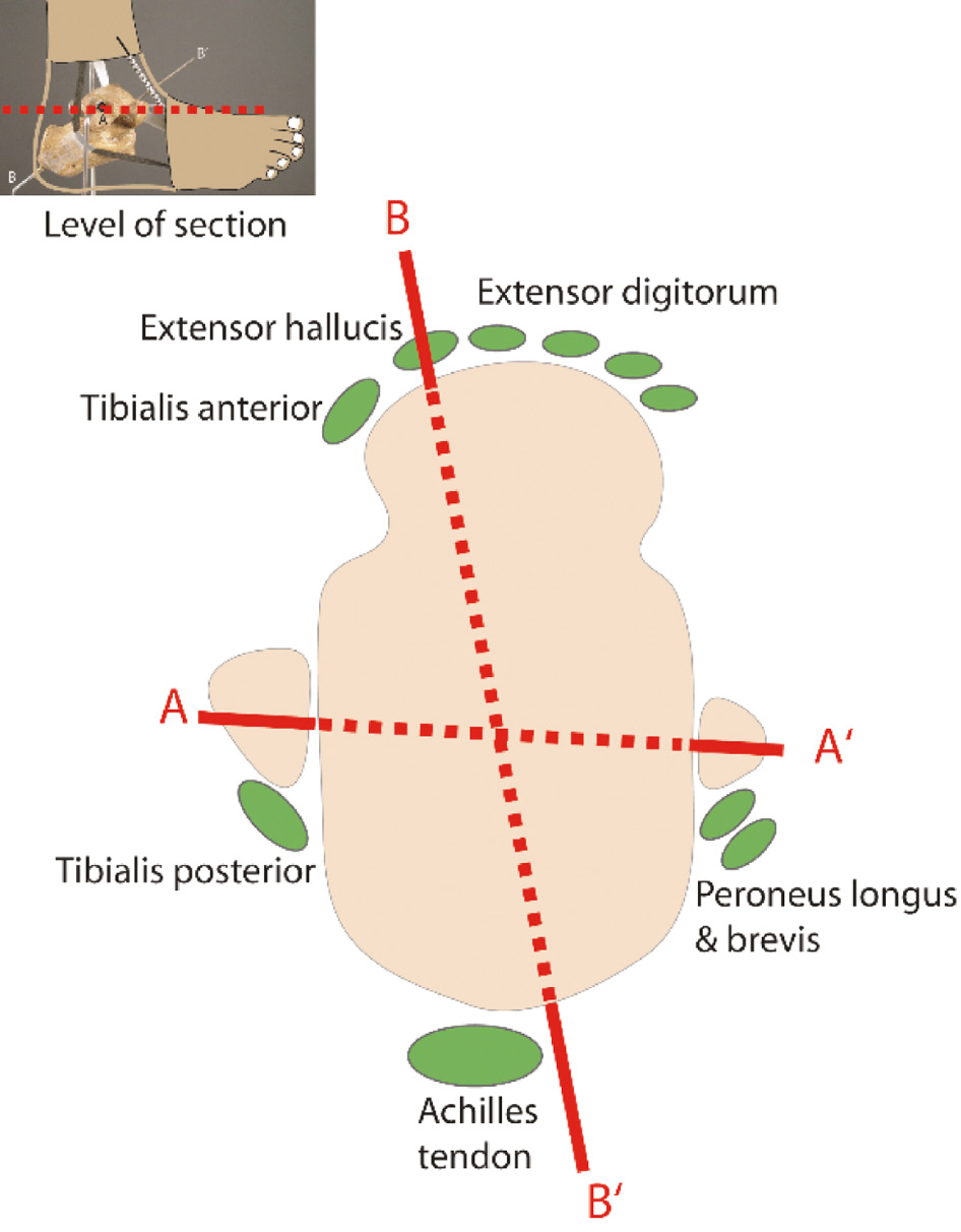 jposna20220038_fig17.jpg