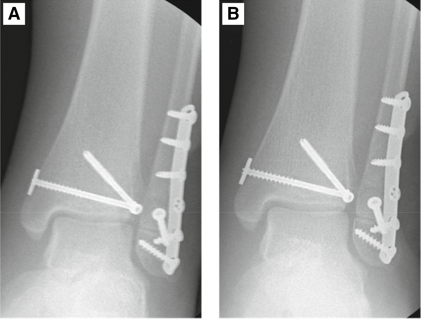 jposna2022553_fig9.jpg