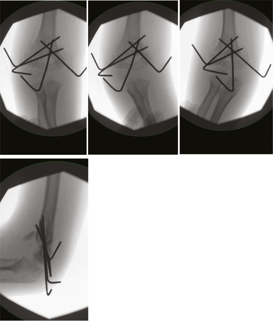 jposna2023665_fig5.jpg