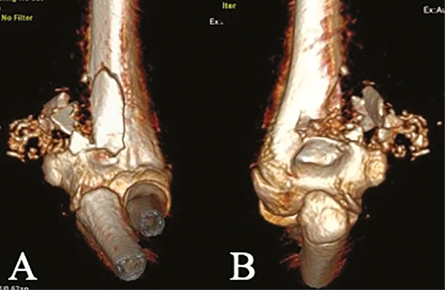 jposna2023683_fig3.jpg