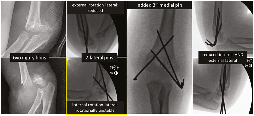 jposna2023699_fig1.jpg