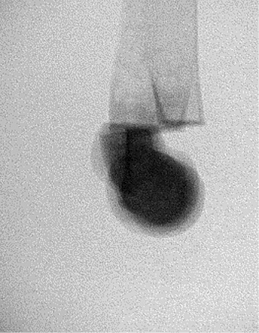 jposna2023699_fig3.jpg
