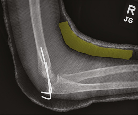 jposna2023699_fig5.jpg