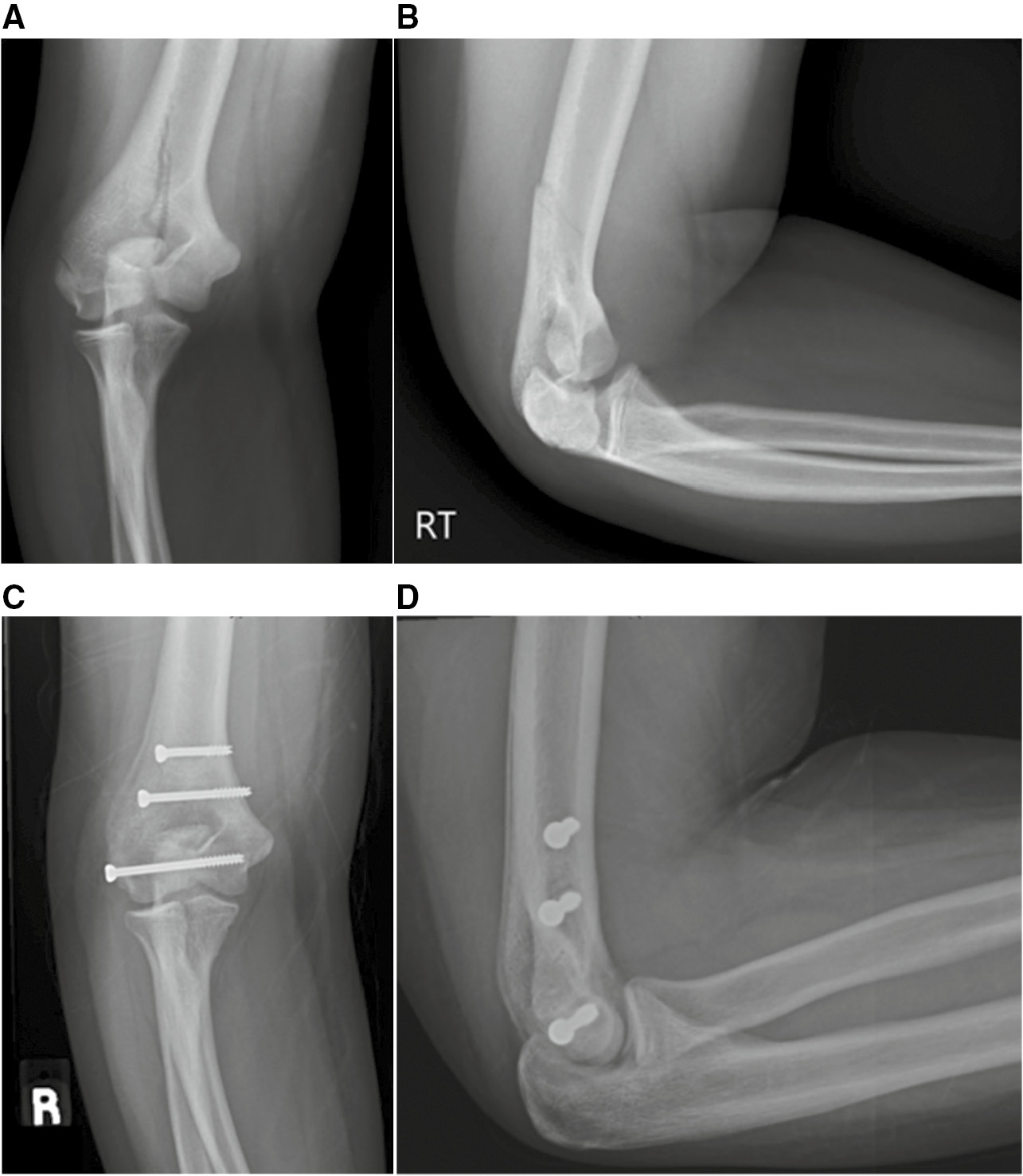 jposna2023716_fig1.jpg