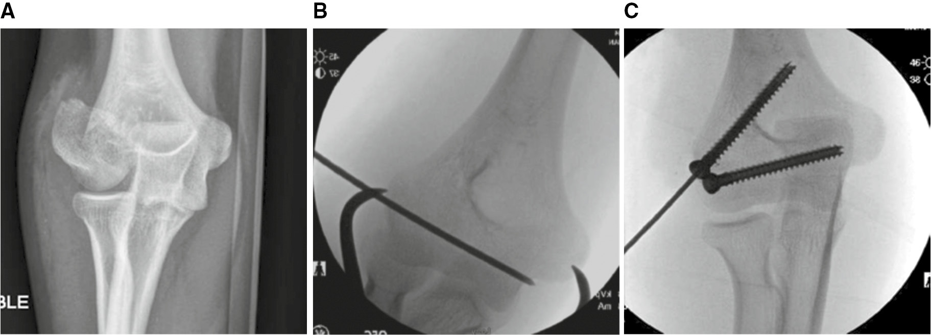 jposna2023716_fig2.jpg