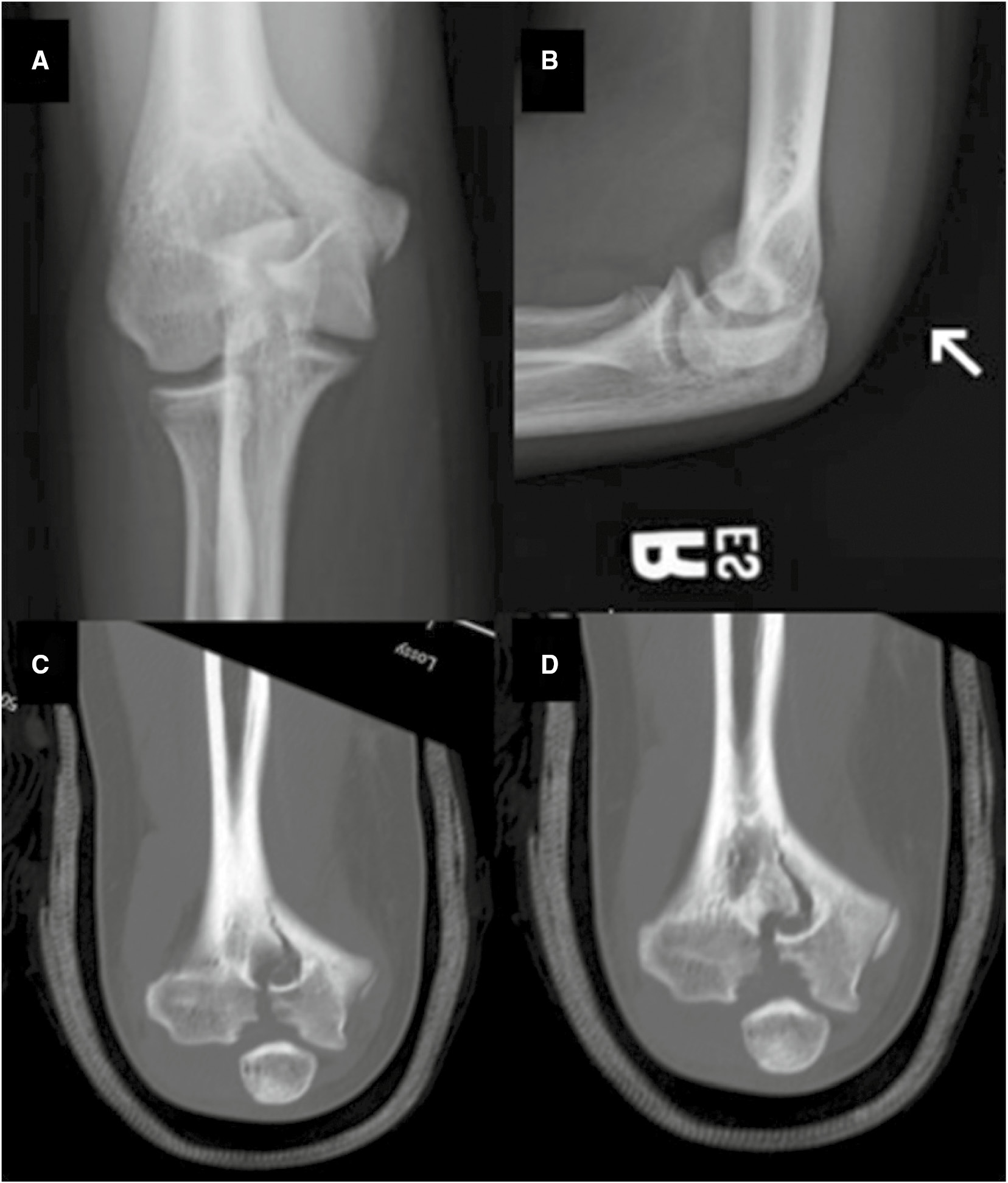 jposna2023716_fig3.jpg