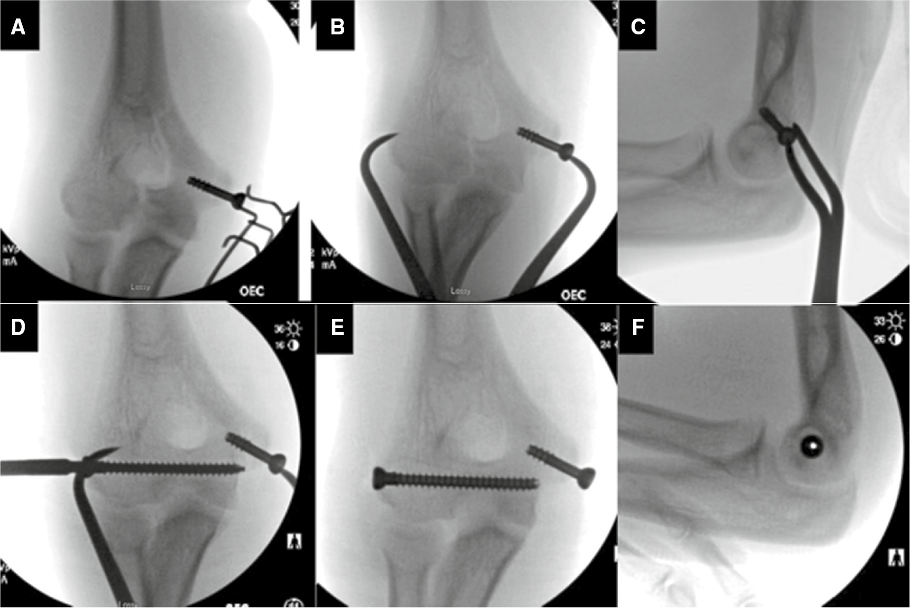 jposna2023716_fig4.jpg