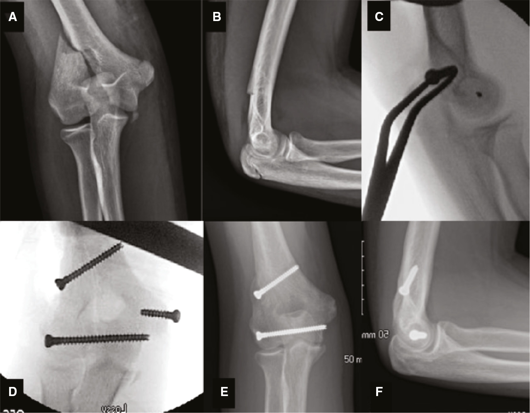 jposna2023716_fig6.jpg